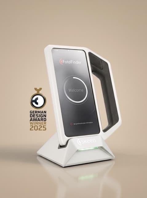 FotoFinder skeen digital dermatoscope used for scalp analysis at MHB Clinic London