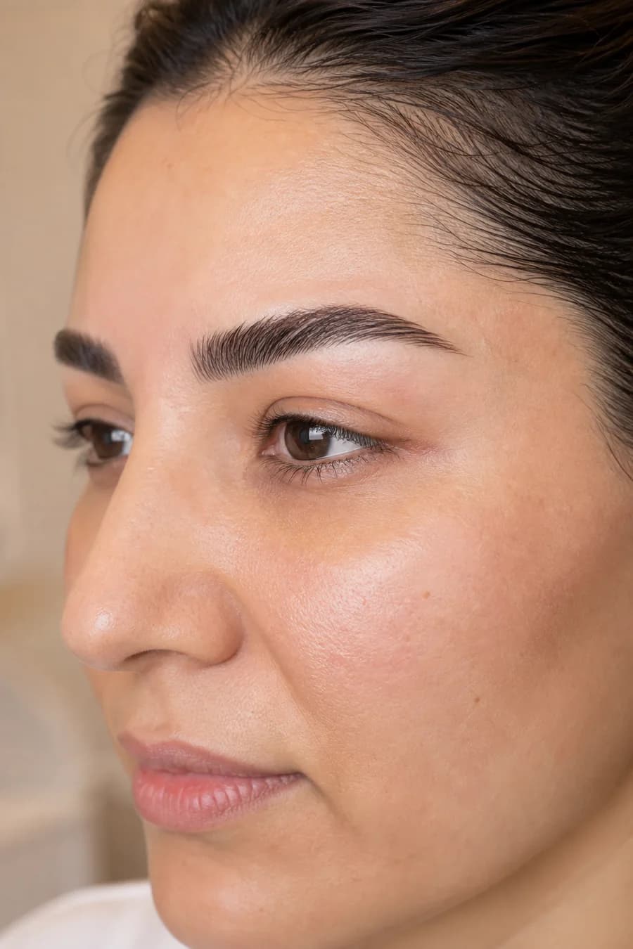 Eyebrow Transplant at MHB Clinic London
