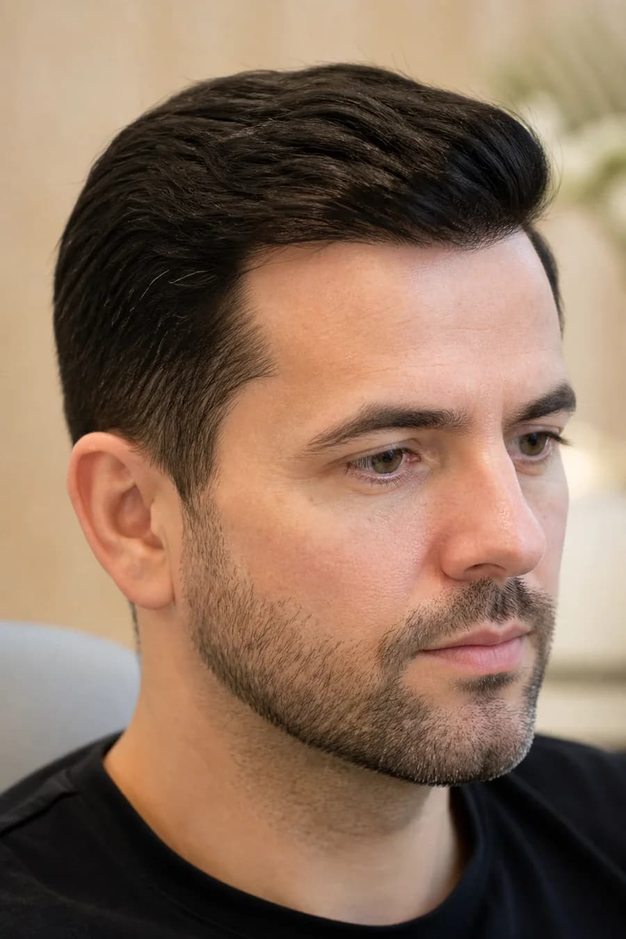 Hair PRP treatment results at MHB Clinic London