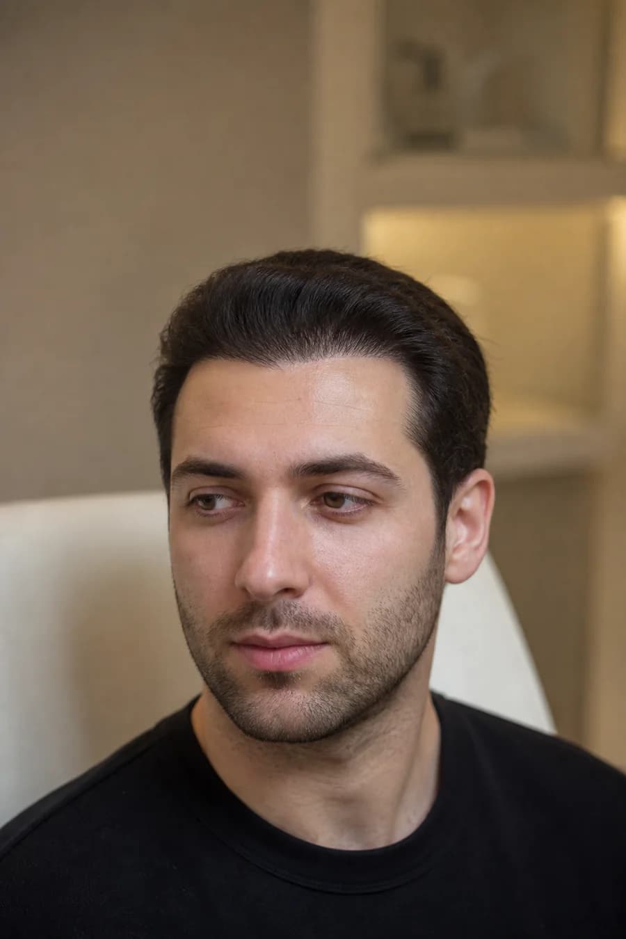 Hairline Hair Transplant at MHB Clinic London