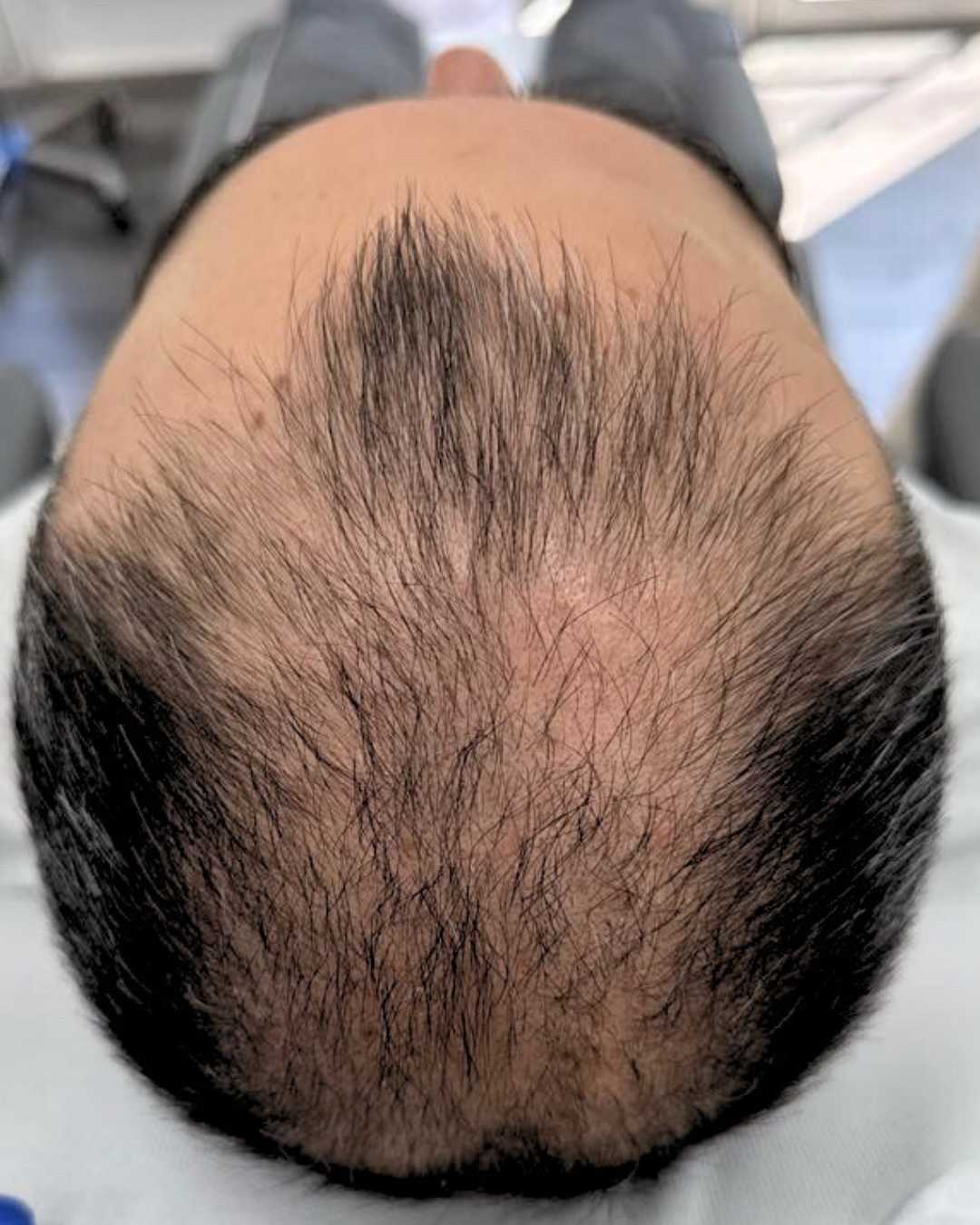 Case 01 before