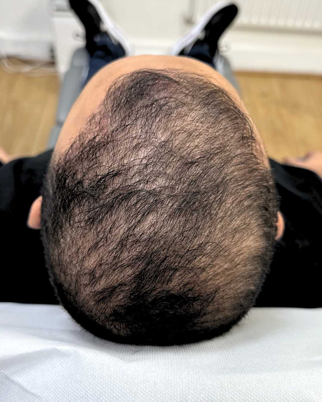 Case 02 after 3 months