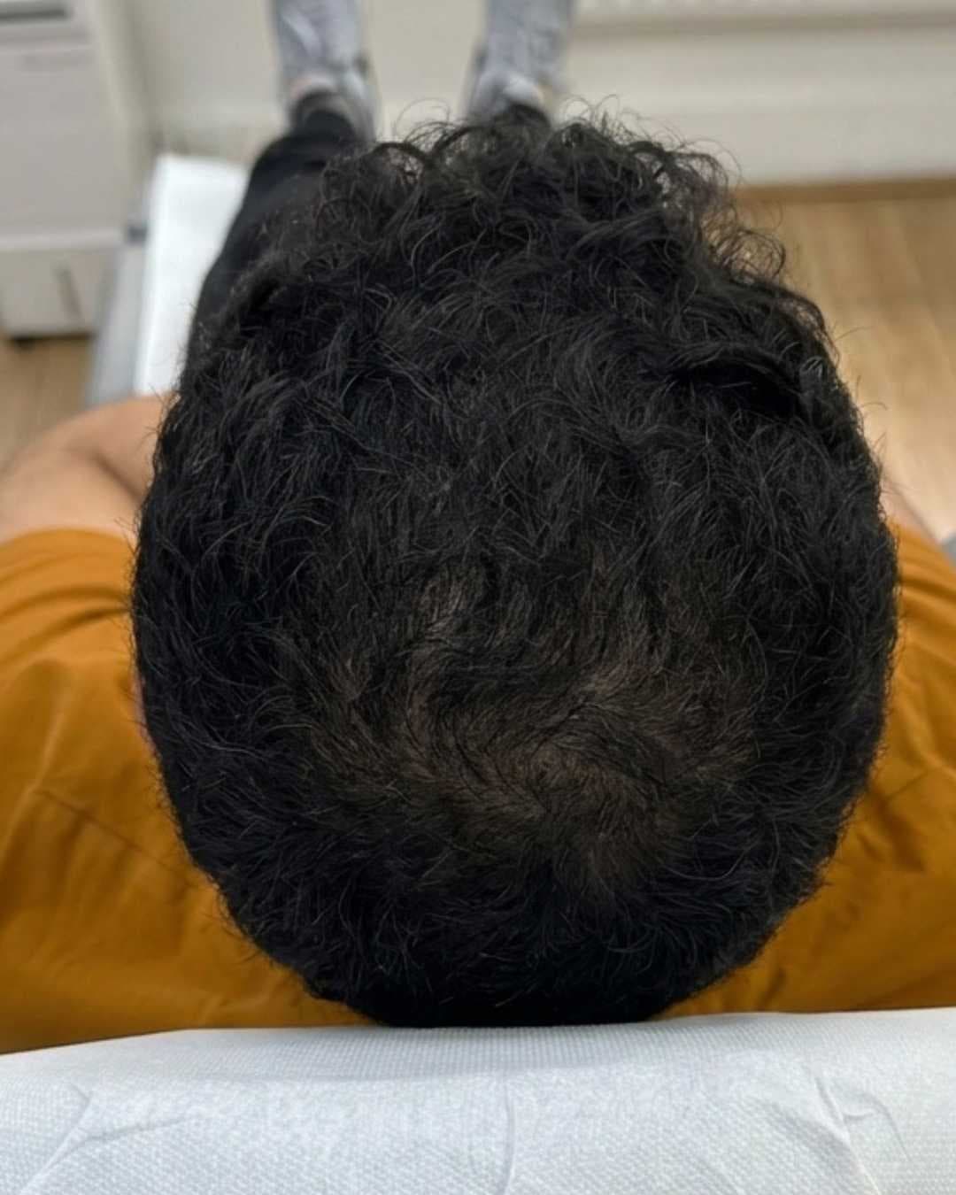 Case 03 after 4 months