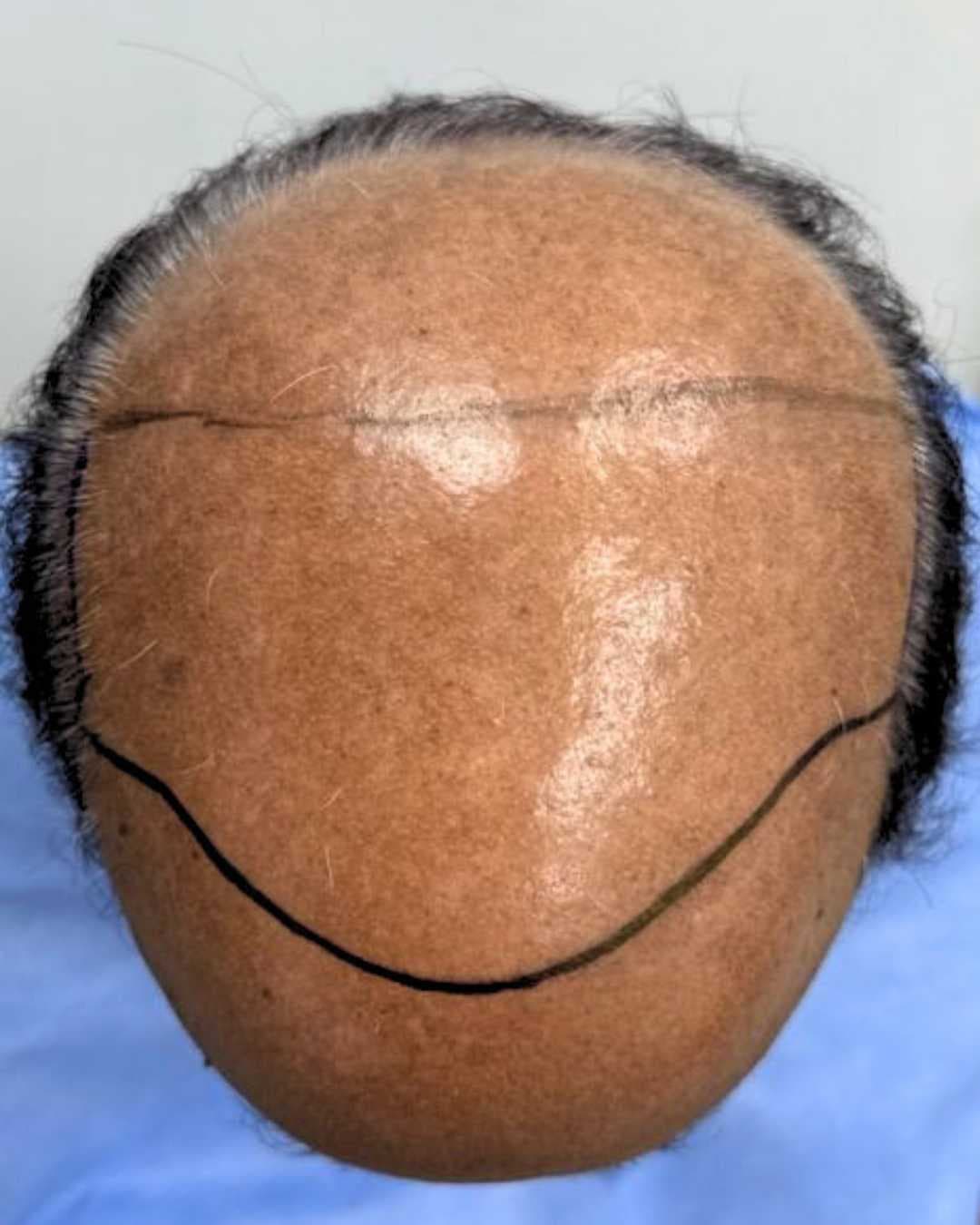 Case 04 before