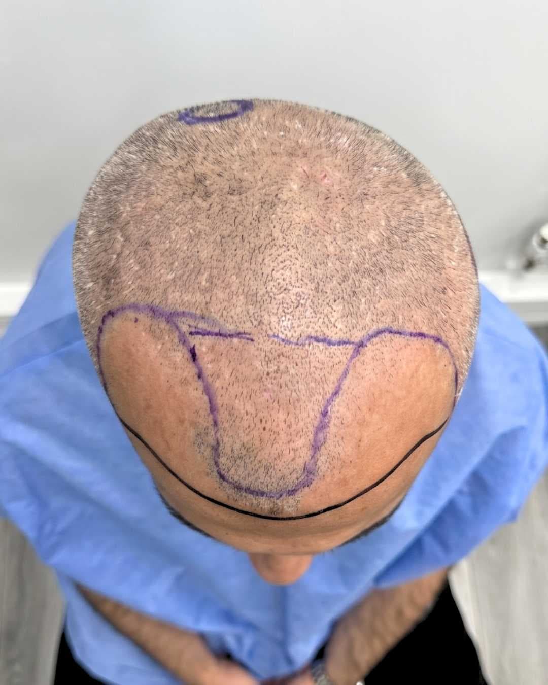 Case 05 before