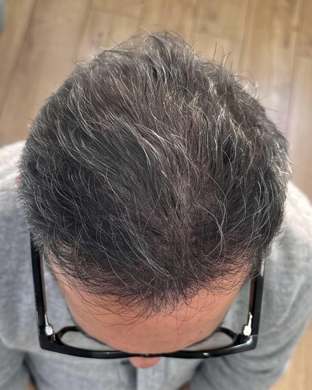 Case 06 after 7 months