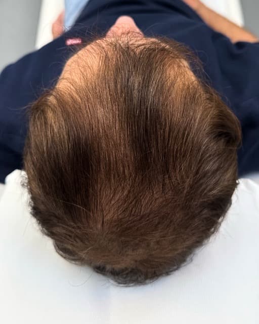 Case 05 after Treatment