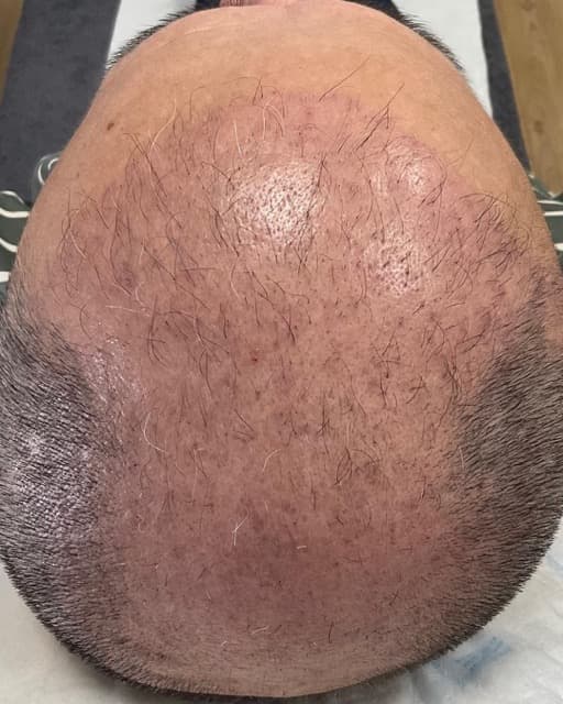 Case 06 before