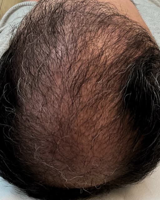 Case 06 after Treatment