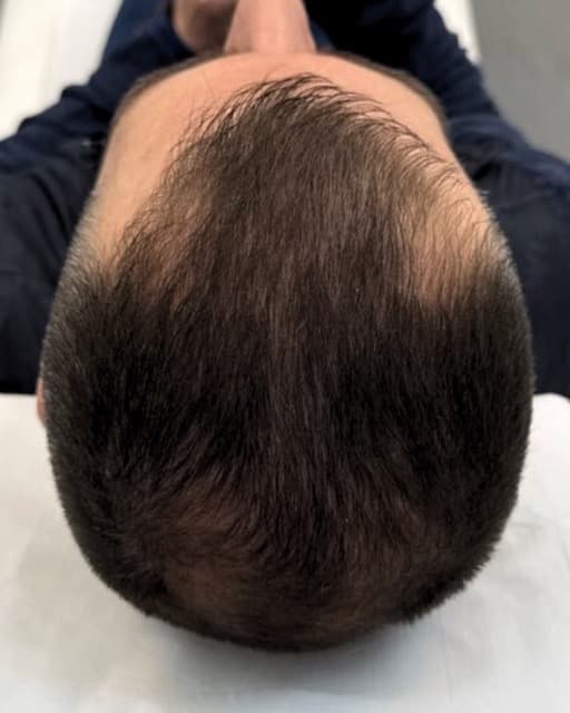 Case 07 after Treatment