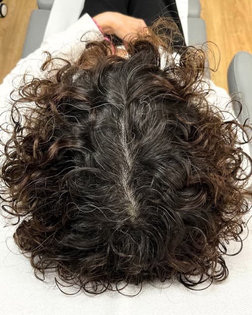 Case 08 after Treatment
