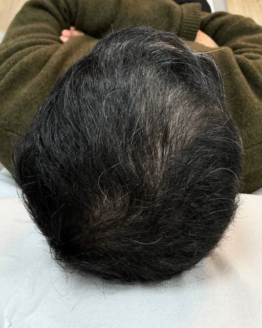 Case 09 after Treatment