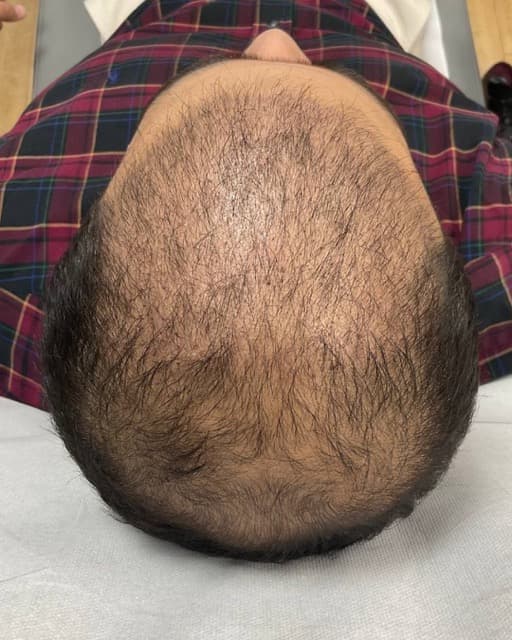 Case 10 before
