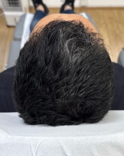 Case 01 after Treatment