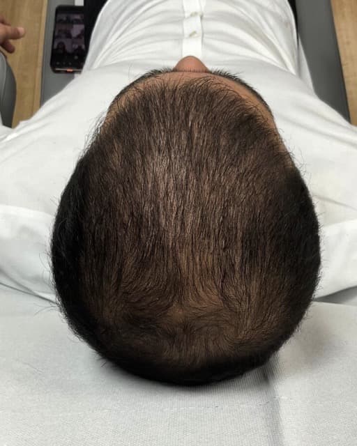 Case 10 after Treatment