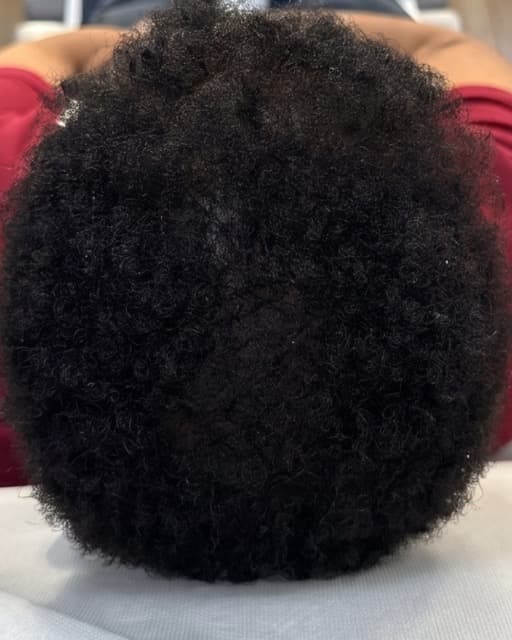 Case 02 after Treatment