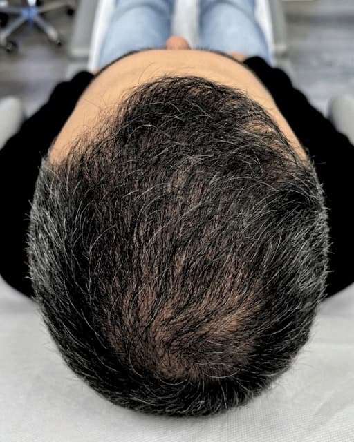 Case 03 after Treatment