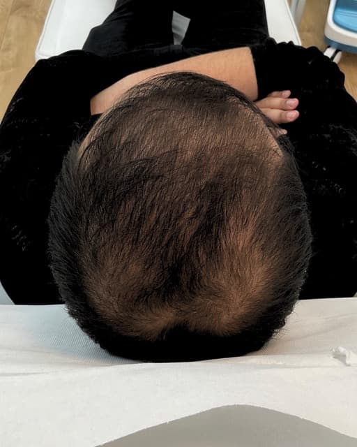 Case 04 after Treatment