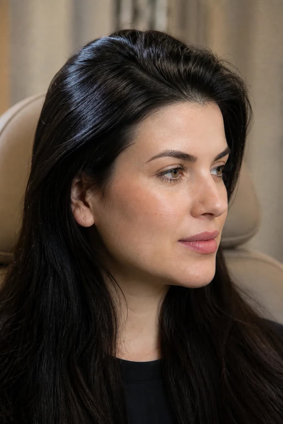 MCT Exosomes hair treatment results at MHB Clinic London